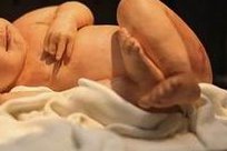 一对一咨询女性有高血压做广州三代试管婴儿会有什么风险吗？